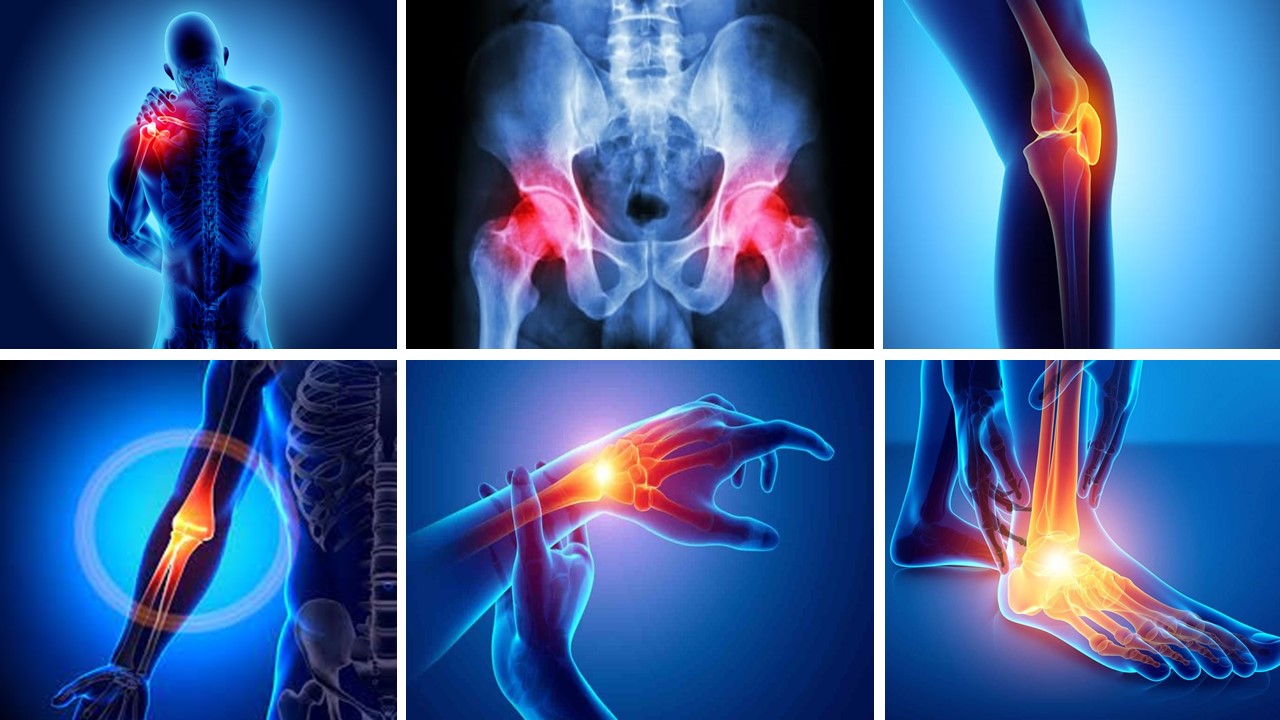 Steroid Joint Injection Therapy Mersea Road Clinic